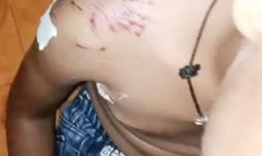 कुत्ते के हमले से मासूम सहित 3 घायल