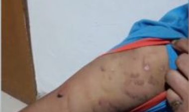 नाबालिग नौकरानी को पीटा, बच्ची को पुलिस ने कराया मुक्त, मुकदमा दर्ज