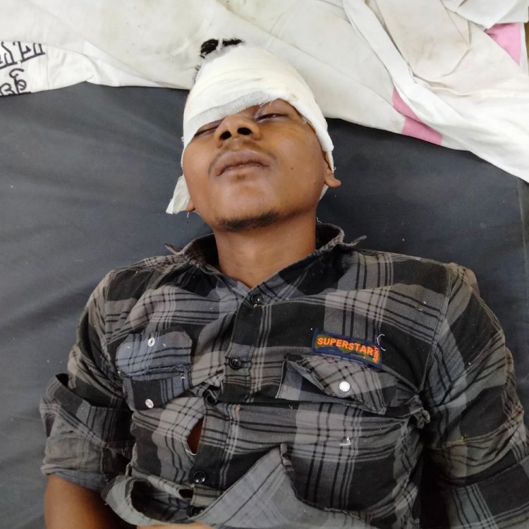 नींद का झोंका आने पर ट्रेन से गिरा युवक:छठ पूजा के लिए मुंबई से पटना जा रहा था; जिला अस्पताल में इलाज जारी