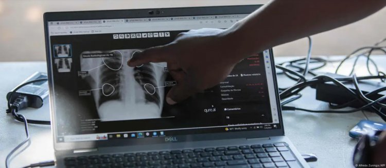 भारत को टीबी मुक्त बनाने की दिशा में आ रही अड़चनें