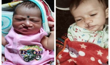 रायपुर : चिरायु योजना से नन्हें शिवम को मिली नई मुस्कान