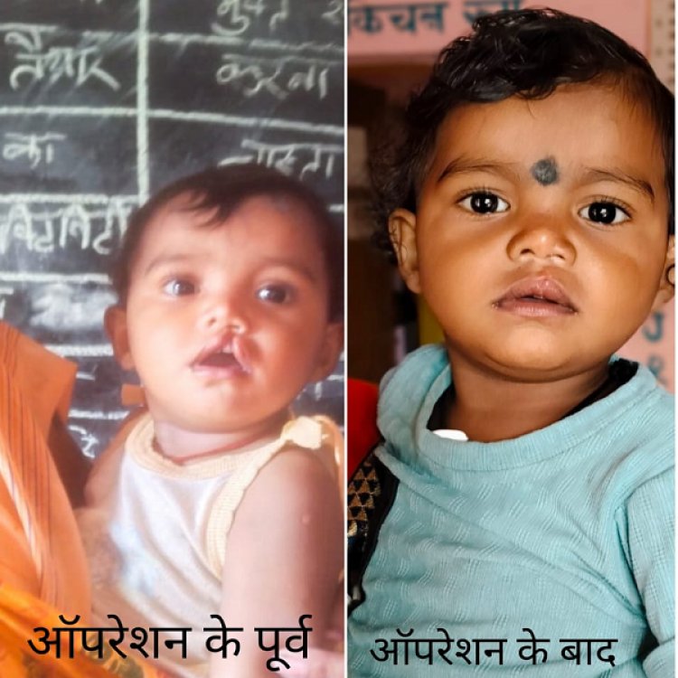 शासन की योजना से दूर हुई बेटी के भविष्य की चिंता, चिरायु दल ने लौटाई मासूम रंजना की मुस्कान